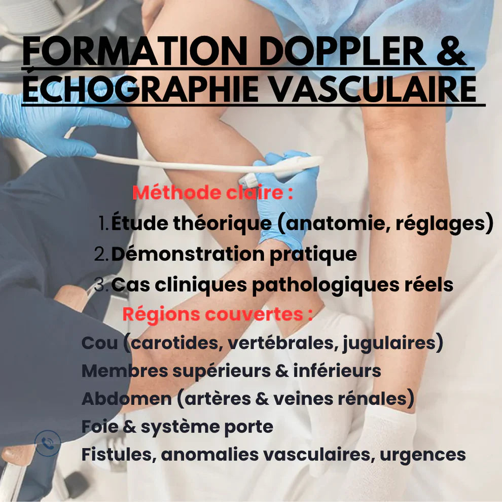 Formation Premium Doppler & Échographie Vasculaire : 800 € de valeur, seulement 9 500 DA !