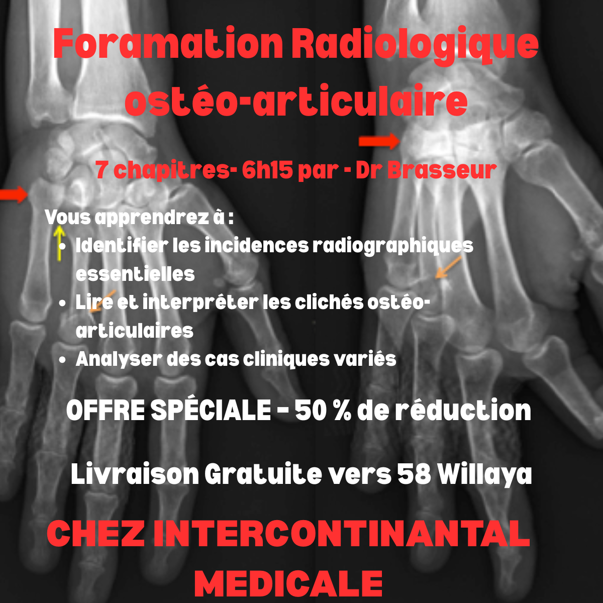 FORMATION PREMIUM DE RADIOLOGIQUE OSTEO-ARTICULAIRE