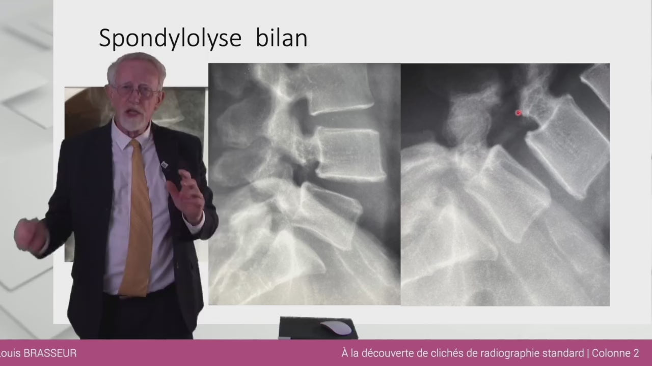 FORMATION PREMIUM DE RADIOLOGIQUE OSTEO-ARTICULAIRE
