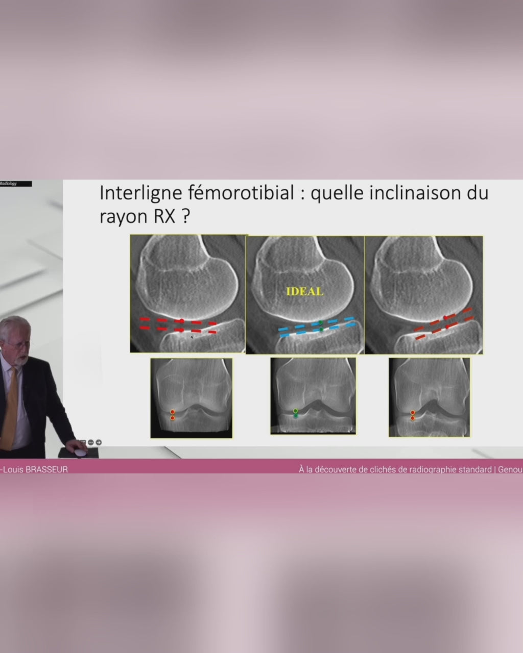 FORMATION PREMIUM DE RADIOLOGIQUE OSTEO-ARTICULAIRE